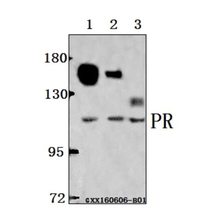 Anti-PR (A394) Antibody from Bioworld Technology (BS1766) - Antibodies.com