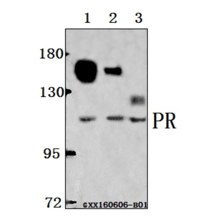 Anti-PR (A394) Antibody from Bioworld Technology (BS1766) - Antibodies.com