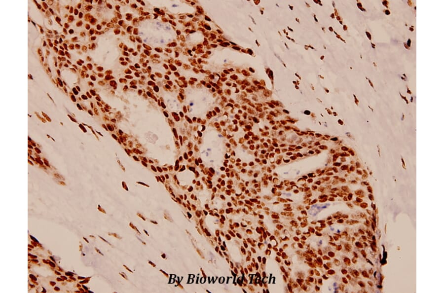 Anti-PR (A394) Antibody from Bioworld Technology (BS1766) - Antibodies.com