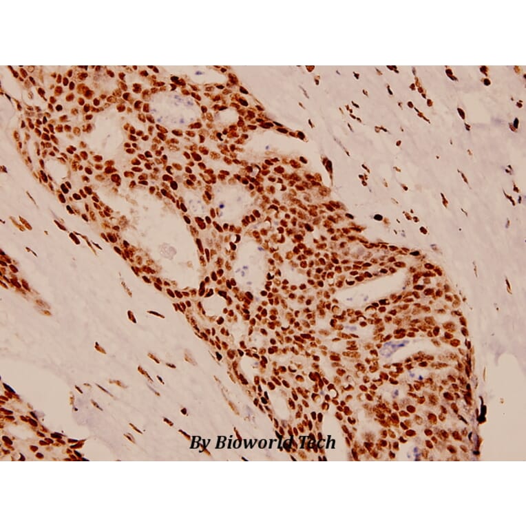 Anti-PR (A394) Antibody from Bioworld Technology (BS1766) - Antibodies.com