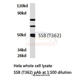 Anti-SSB (T362) Antibody from Bioworld Technology (BS1770) - Antibodies.com