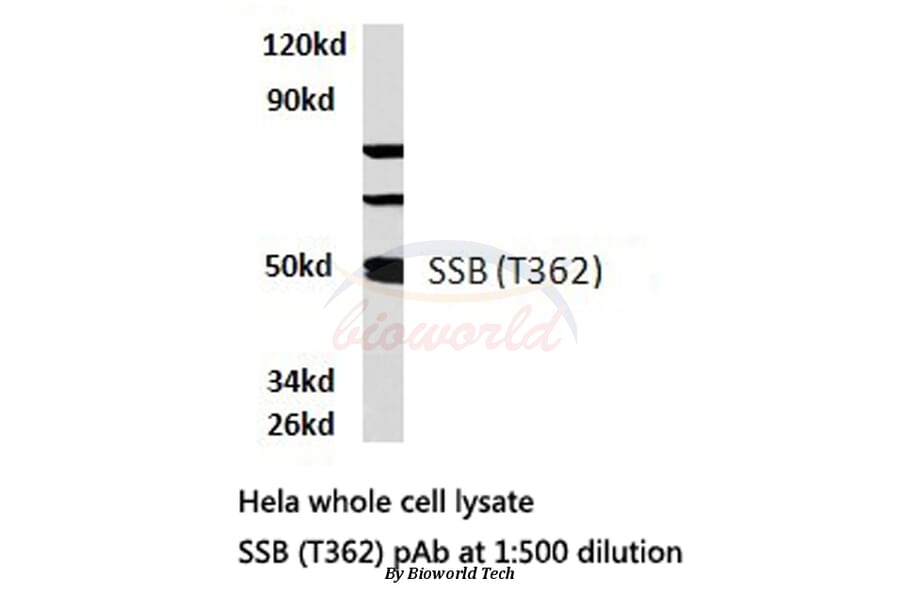 Anti-SSB (T362) Antibody from Bioworld Technology (BS1770) - Antibodies.com