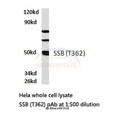 Anti-SSB (T362) Antibody from Bioworld Technology (BS1770) - Antibodies.com