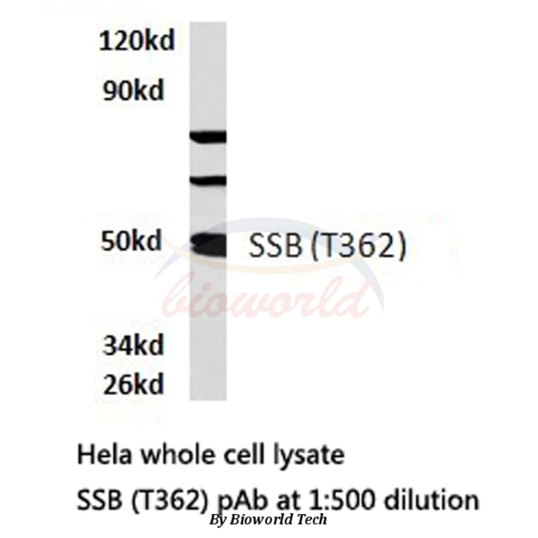 Anti-SSB (T362) Antibody from Bioworld Technology (BS1770) - Antibodies.com