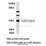 Anti-SSB (T362) Antibody from Bioworld Technology (BS1770) - Antibodies.com