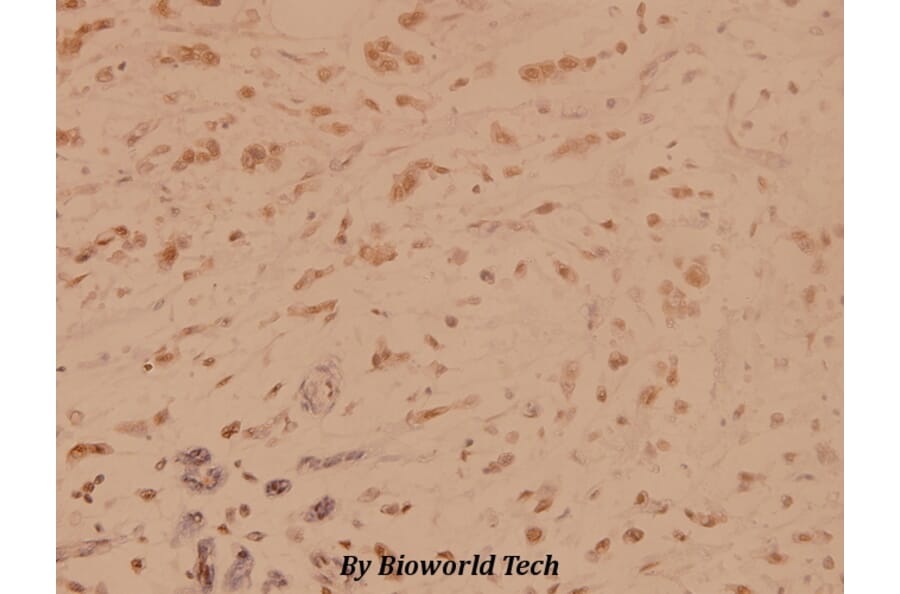 Anti-SSB (T362) Antibody from Bioworld Technology (BS1770) - Antibodies.com