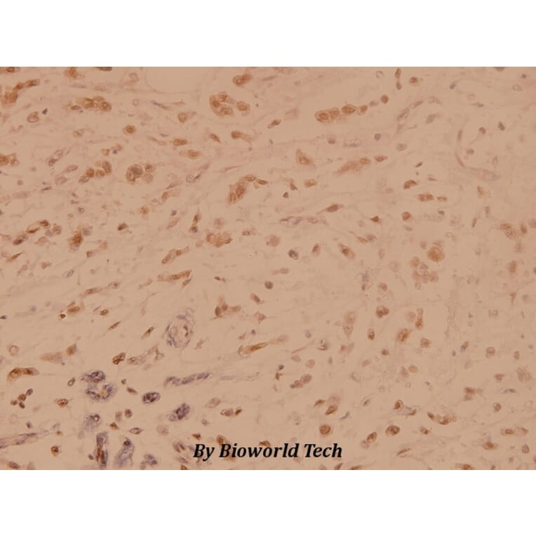 Anti-SSB (T362) Antibody from Bioworld Technology (BS1770) - Antibodies.com