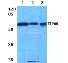 Anti-TIP60 (G82) Antibody from Bioworld Technology (BS1772) - Antibodies.com