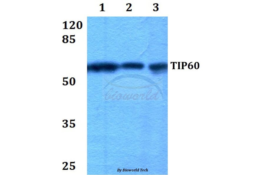 Anti-TIP60 (G82) Antibody from Bioworld Technology (BS1772) - Antibodies.com