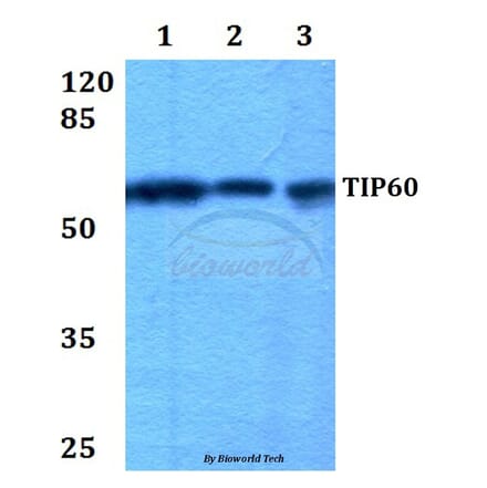 Anti-TIP60 (G82) Antibody from Bioworld Technology (BS1772) - Antibodies.com
