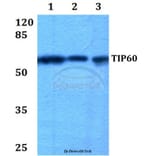 Anti-TIP60 (G82) Antibody from Bioworld Technology (BS1772) - Antibodies.com