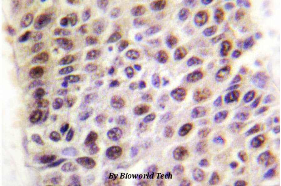 Anti-TIP60 (G82) Antibody from Bioworld Technology (BS1772) - Antibodies.com