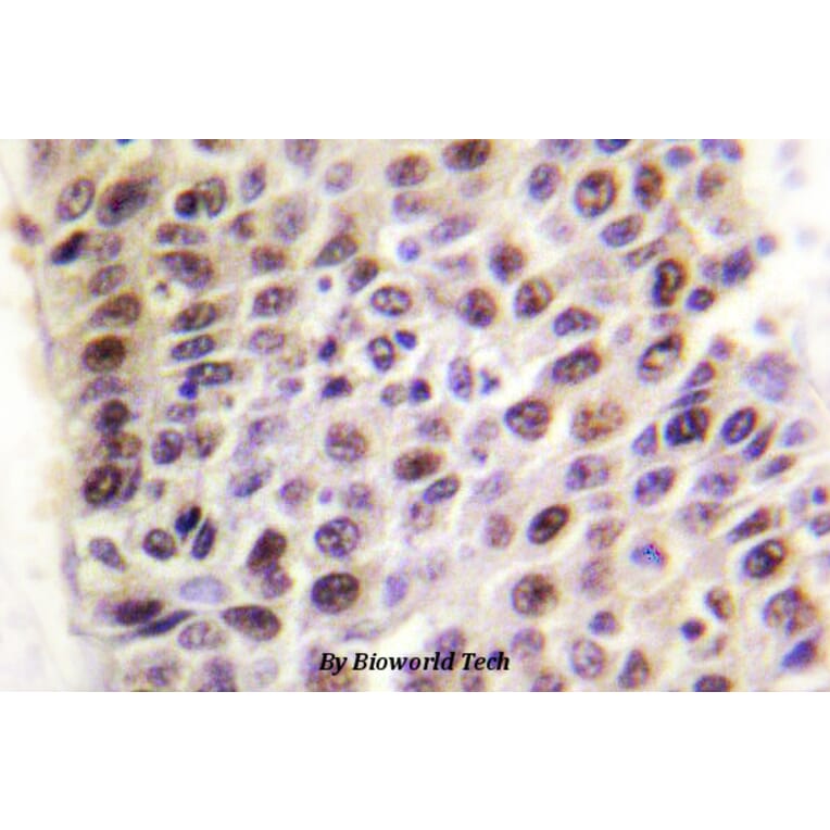 Anti-TIP60 (G82) Antibody from Bioworld Technology (BS1772) - Antibodies.com