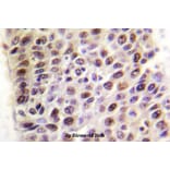 Anti-TIP60 (G82) Antibody from Bioworld Technology (BS1772) - Antibodies.com