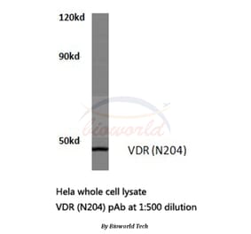 Anti-VDR (N204) Antibody from Bioworld Technology (BS1774) - Antibodies.com