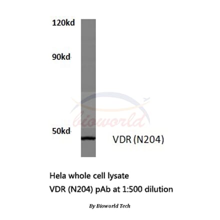 Anti-VDR (N204) Antibody from Bioworld Technology (BS1774) - Antibodies.com