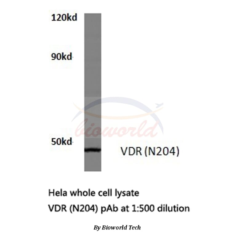 Anti-VDR (N204) Antibody from Bioworld Technology (BS1774) - Antibodies.com