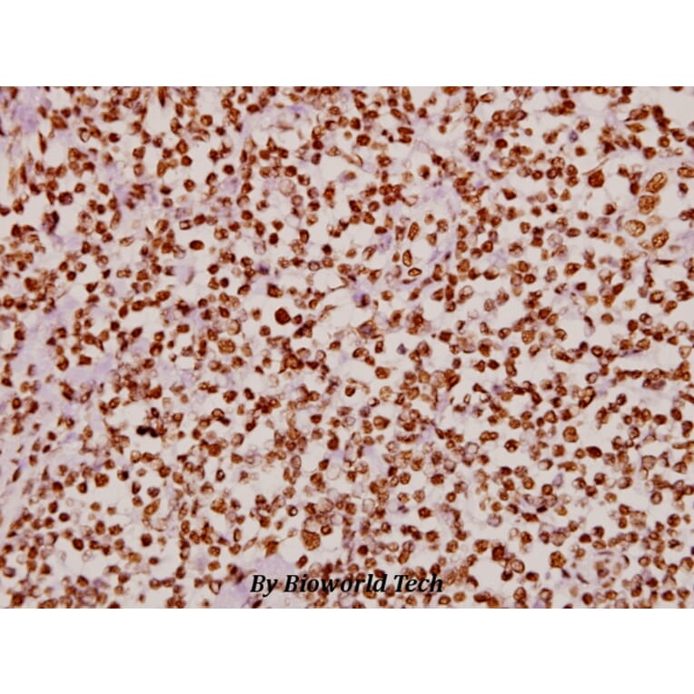 Anti-VDR (N204) Antibody from Bioworld Technology (BS1774) - Antibodies.com