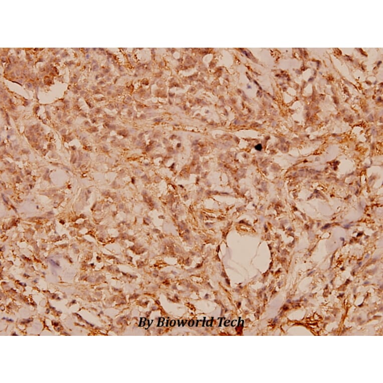 Anti-Wnt-1 (G331) Antibody from Bioworld Technology (BS1777) - Antibodies.com