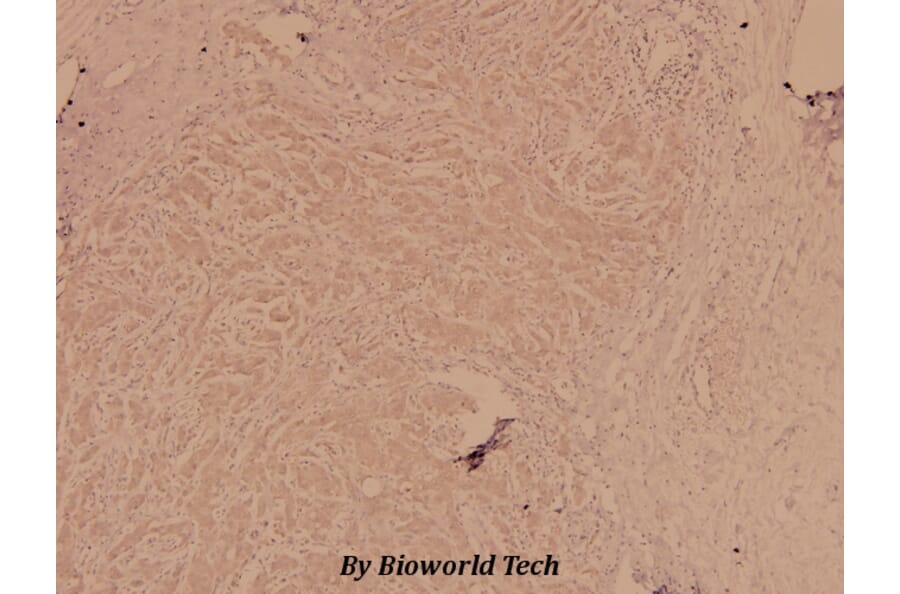 Anti-FGFR1 (L760) Antibody from Bioworld Technology (BS1778) - Antibodies.com