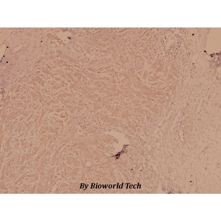 Anti-FGFR1 (L760) Antibody from Bioworld Technology (BS1778) - Antibodies.com