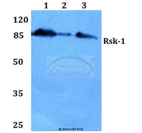 Anti-Rsk-1 (E567) Antibody from Bioworld Technology (BS1779) - Antibodies.com