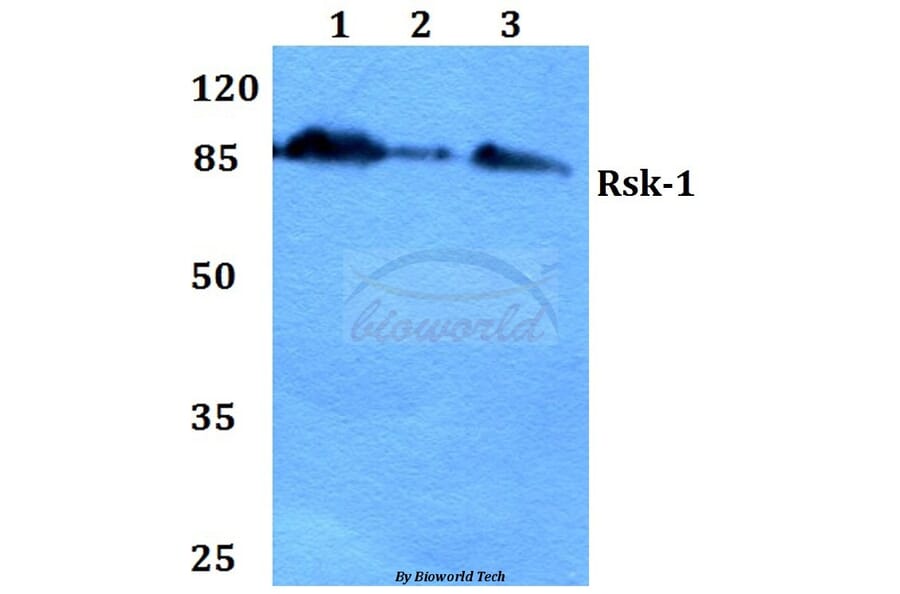 Anti-Rsk-1 (E567) Antibody from Bioworld Technology (BS1779) - Antibodies.com