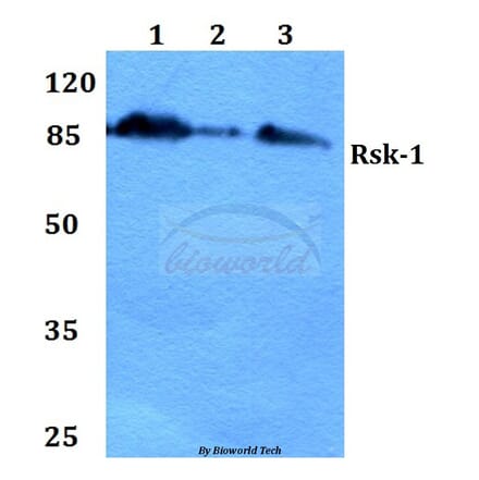Anti-Rsk-1 (E567) Antibody from Bioworld Technology (BS1779) - Antibodies.com