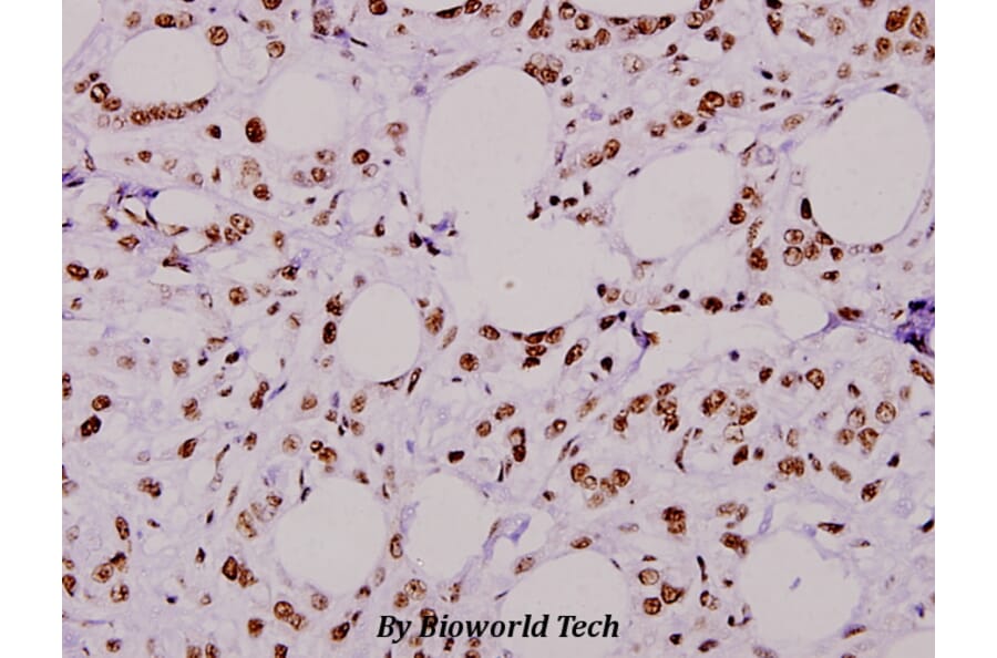 Anti-Rsk-1 (E567) Antibody from Bioworld Technology (BS1779) - Antibodies.com