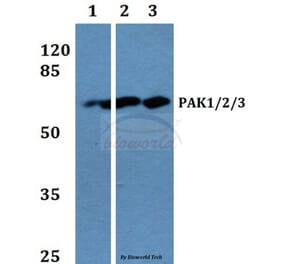 Anti-PAK1/2/3 (K140) Antibody from Bioworld Technology (BS1780) - Antibodies.com