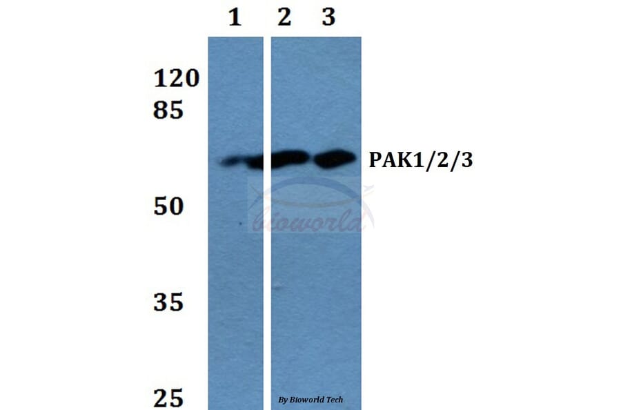 Anti-PAK1/2/3 (K140) Antibody from Bioworld Technology (BS1780) - Antibodies.com