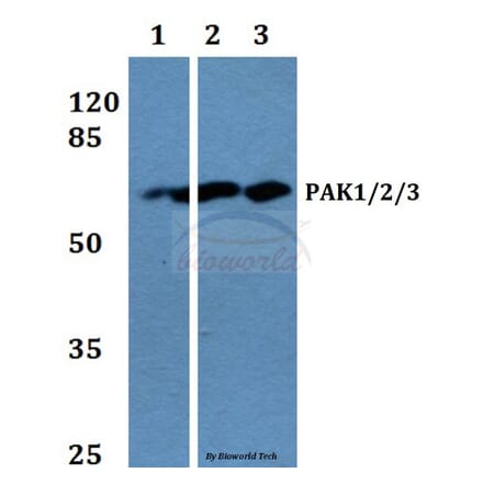 Anti-PAK1/2/3 (K140) Antibody from Bioworld Technology (BS1780) - Antibodies.com