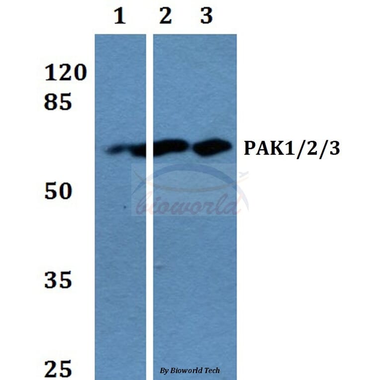 Anti-PAK1/2/3 (K140) Antibody from Bioworld Technology (BS1780) - Antibodies.com
