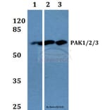 Anti-PAK1/2/3 (K140) Antibody from Bioworld Technology (BS1780) - Antibodies.com