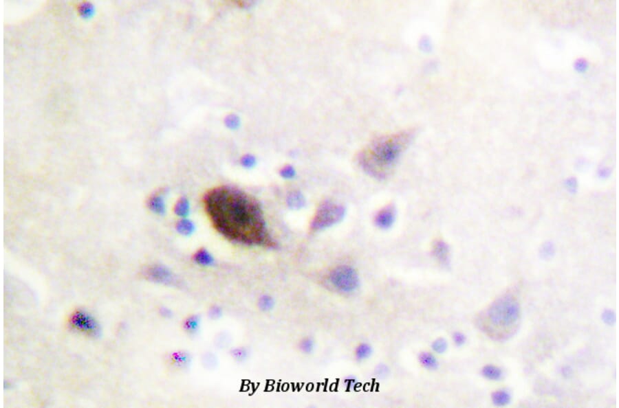 Anti-PAK1/2/3 (K140) Antibody from Bioworld Technology (BS1780) - Antibodies.com