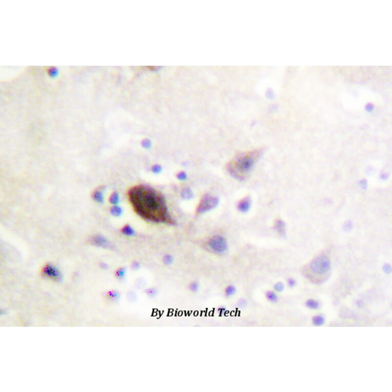 Anti-PAK1/2/3 (K140) Antibody from Bioworld Technology (BS1780) - Antibodies.com