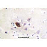 Anti-PAK1/2/3 (K140) Antibody from Bioworld Technology (BS1780) - Antibodies.com