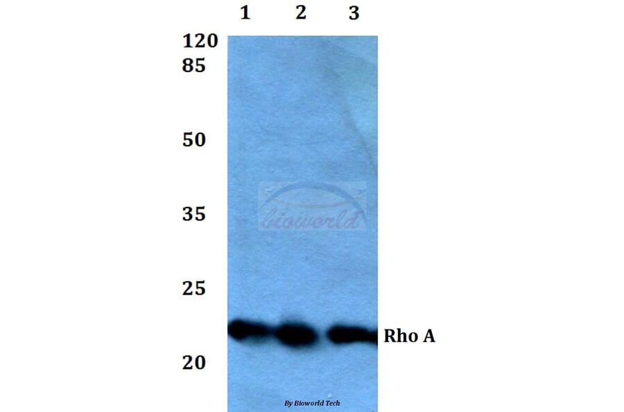 Anti-Rho A (R182) Antibody from Bioworld Technology (BS1782) - Antibodies.com