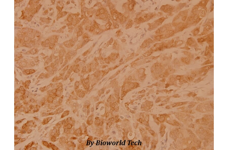 Anti-Rho A (R182) Antibody from Bioworld Technology (BS1782) - Antibodies.com