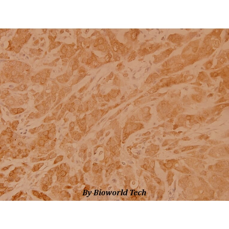 Anti-Rho A (R182) Antibody from Bioworld Technology (BS1782) - Antibodies.com