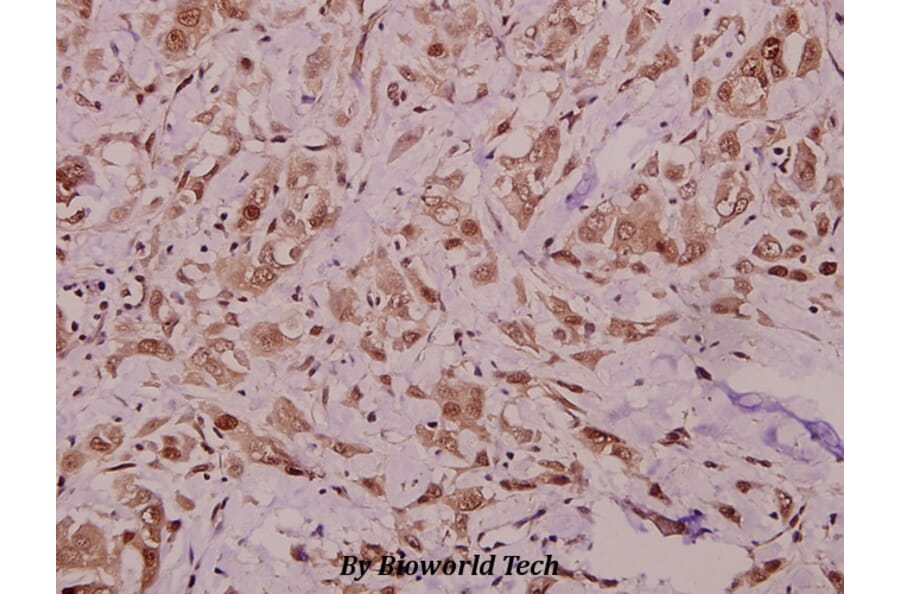 Anti-RyR2 (N2802) Antibody from Bioworld Technology (BS1783) - Antibodies.com
