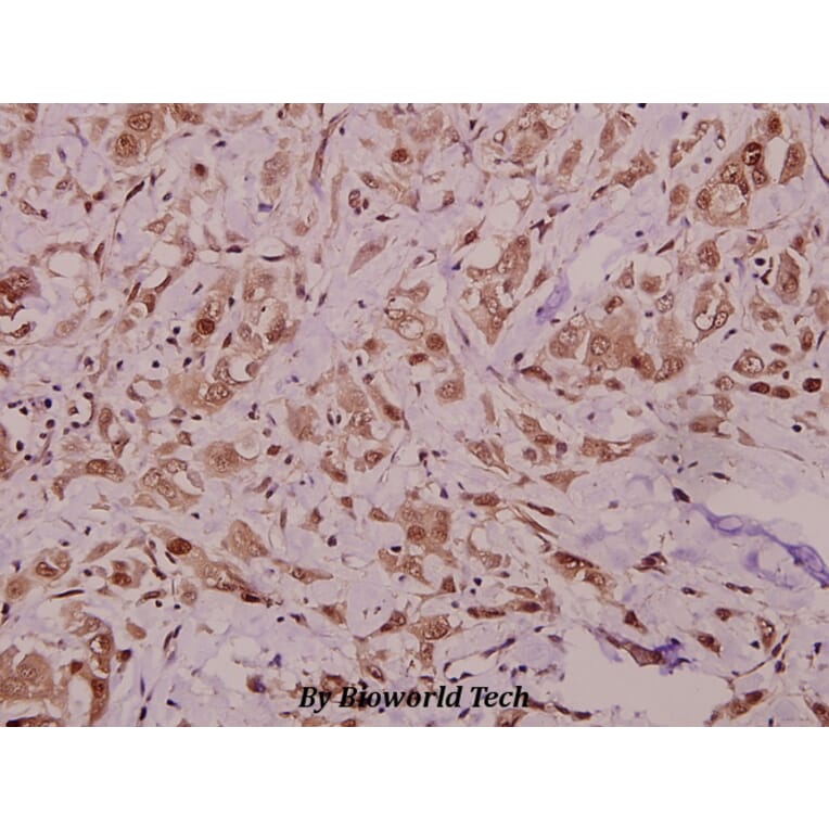 Anti-RyR2 (N2802) Antibody from Bioworld Technology (BS1783) - Antibodies.com