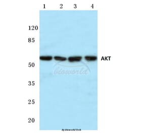 Anti-AKT (P470) Antibody from Bioworld Technology (BS1784) - Antibodies.com