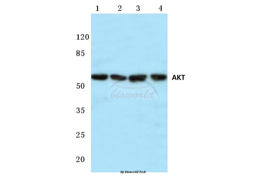 Anti-AKT (P470) Antibody from Bioworld Technology (BS1784) - Antibodies.com