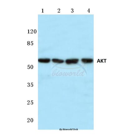 Anti-AKT (P470) Antibody from Bioworld Technology (BS1784) - Antibodies.com