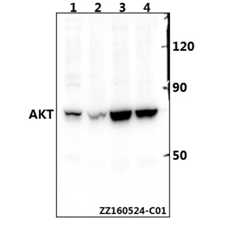 Anti-AKT (P470) Antibody from Bioworld Technology (BS1784) - Antibodies.com