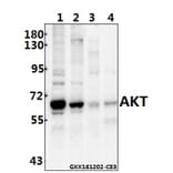 Anti-AKT (P470) Antibody from Bioworld Technology (BS1784) - Antibodies.com