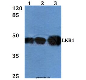 Anti-LKB1 (R425) Antibody from Bioworld Technology (BS1785) - Antibodies.com