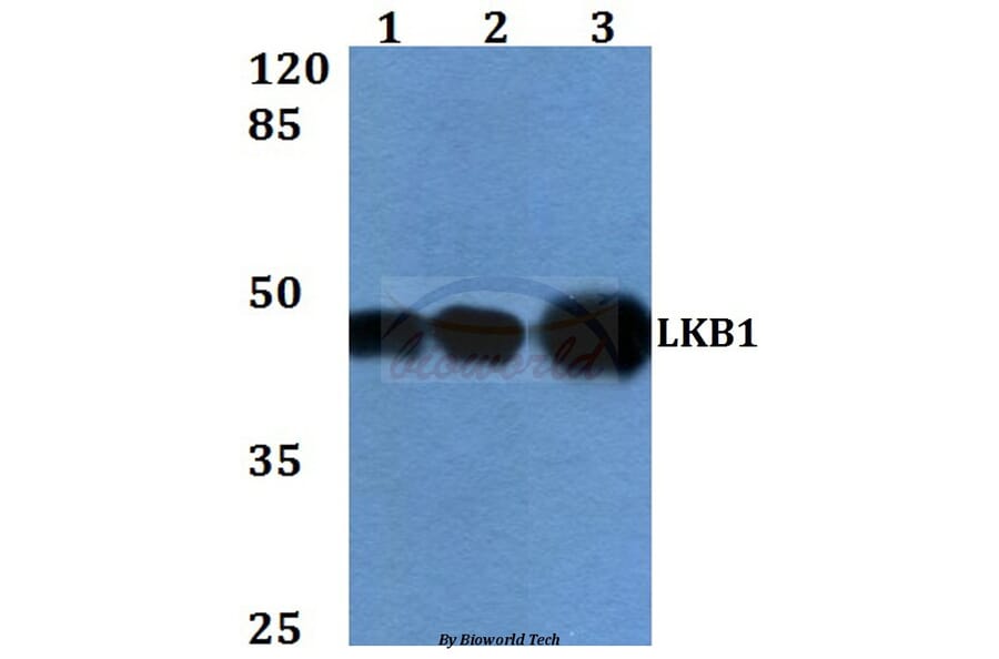 Anti-LKB1 (R425) Antibody from Bioworld Technology (BS1785) - Antibodies.com