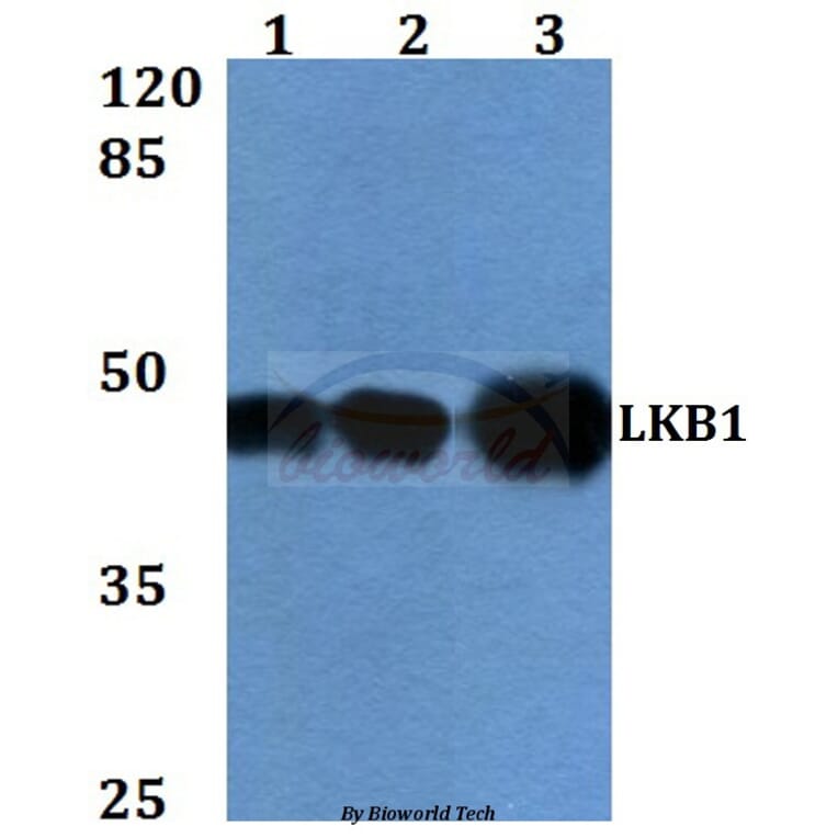 Anti-LKB1 (R425) Antibody from Bioworld Technology (BS1785) - Antibodies.com